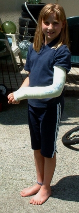 Melanie broken arm 8/02